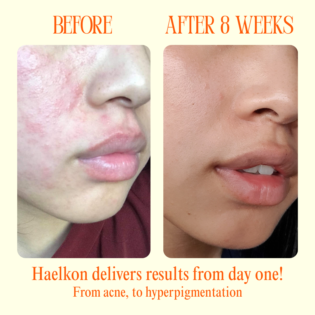 Haelkon - Orange Enzyme Exfoliating Gel